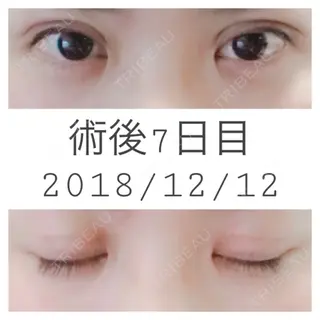 7日目の経過画像（1枚目）