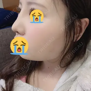 6日目の経過画像（2枚目）