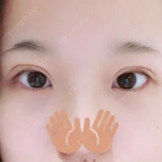 1日目の経過画像（1枚目）