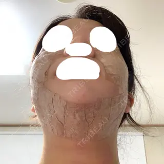 3日目の経過画像（2枚目）