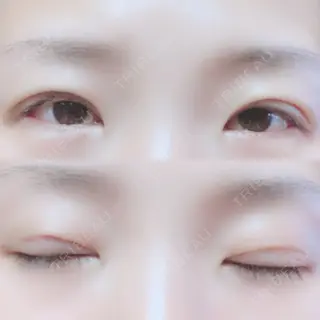 8日目の経過画像（1枚目）