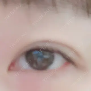 10日目の経過画像（3枚目）