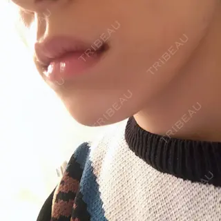 0日目の経過画像（3枚目）