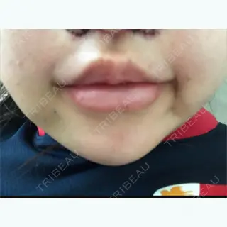 2日目の経過画像（2枚目）