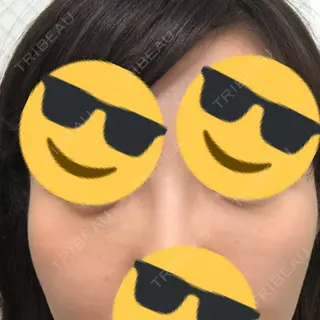 8日目の経過画像（1枚目）