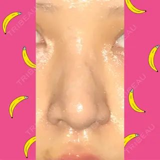 61日目の経過画像（1枚目）