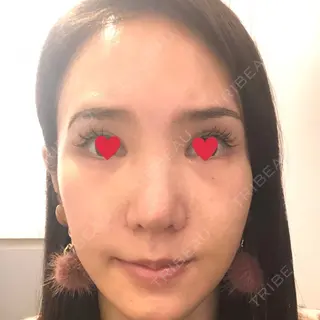 10日目の経過画像（1枚目）