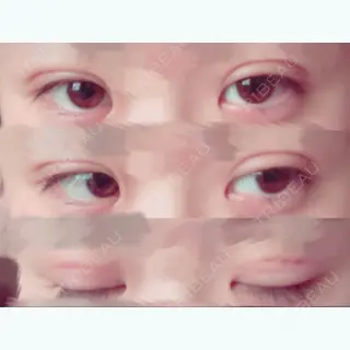 30日目の経過画像（1枚目）
