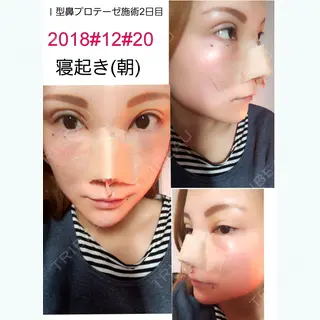 2日目の経過画像（1枚目）