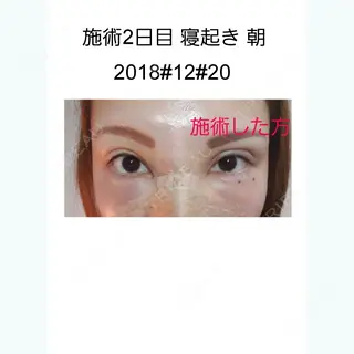 2日目の経過画像（2枚目）