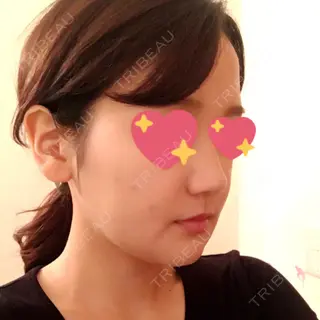 24日目の経過画像（2枚目）