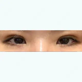 2日目の経過画像（1枚目）