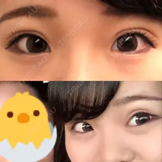 7日目の経過画像（1枚目）
