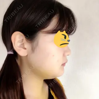 7日目の経過画像（3枚目）