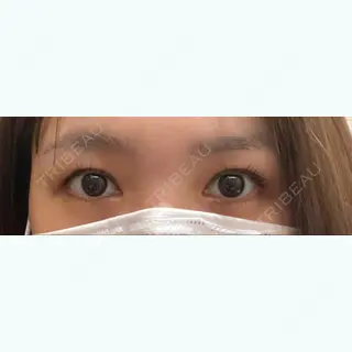 750日目の経過画像（1枚目）