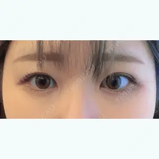 777日目の経過画像（2枚目）