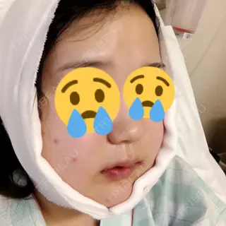 1日目の経過画像（2枚目）