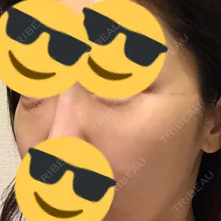 9日目の経過画像（2枚目）