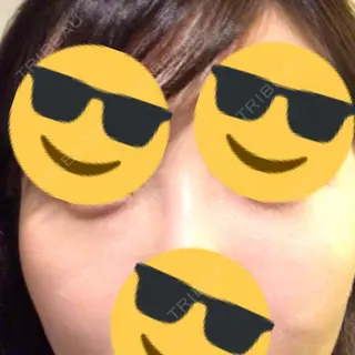 13日目の経過画像（1枚目）