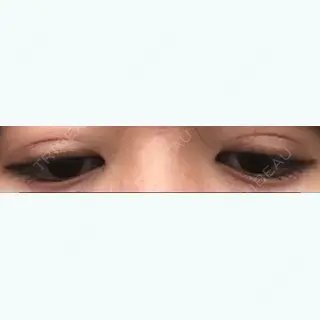 99日目の経過画像（1枚目）