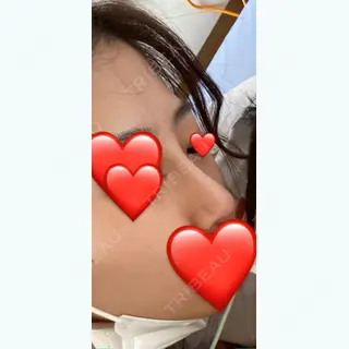 215日目の経過画像（2枚目）