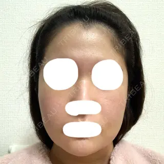 10日目の経過画像（1枚目）