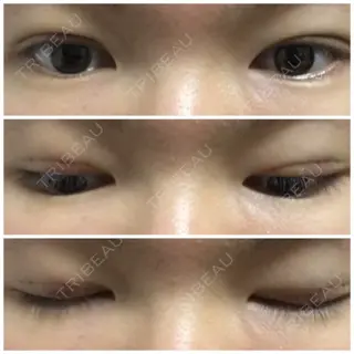 2日目の経過画像（1枚目）