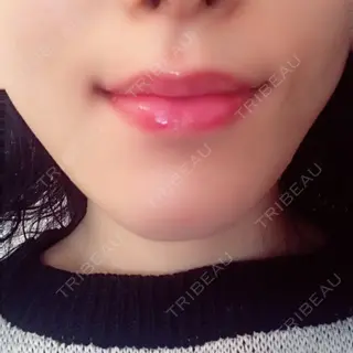 9日目の経過画像（2枚目）