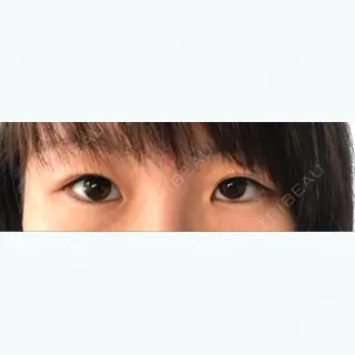 113日目の経過画像（1枚目）
