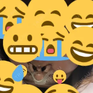 3日目の経過画像（2枚目）
