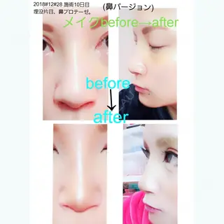 10日目の経過画像（1枚目）