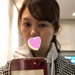4日目の経過画像（3枚目）