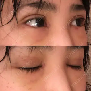 8日目の経過画像（2枚目）