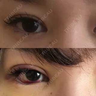 3日目の経過画像（3枚目）