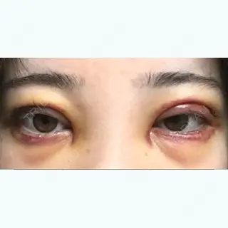 3日目の経過画像（1枚目）
