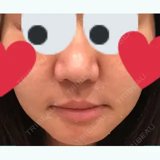 2日目の経過画像（2枚目）