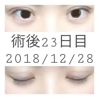 23日目の経過画像（1枚目）