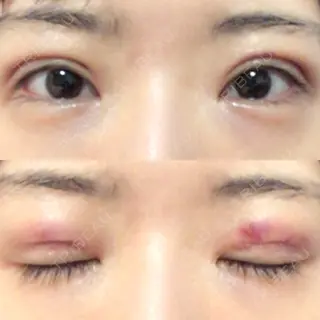 2日目の経過画像（1枚目）