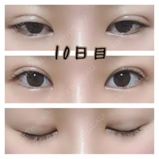 10日目の経過画像（1枚目）