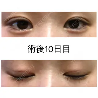 9日目の経過画像（1枚目）