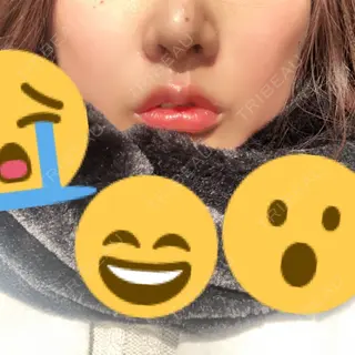 7日目の経過画像（1枚目）