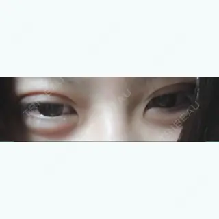 0日目の経過画像（3枚目）