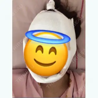 0日目の経過画像（1枚目）