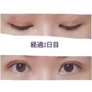 2日目の経過画像（1枚目）
