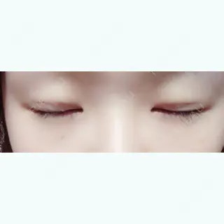 4日目の経過画像（2枚目）