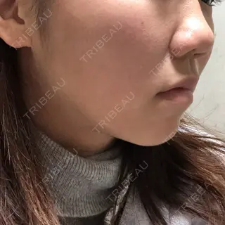 131日目の経過画像（2枚目）