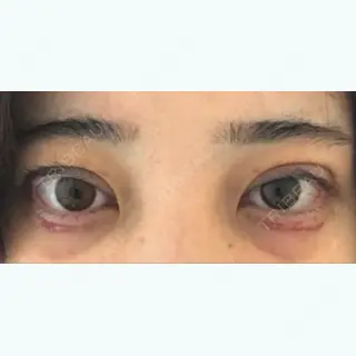 8日目の経過画像（1枚目）