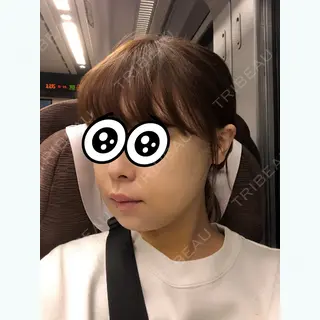 5日目の経過画像（2枚目）