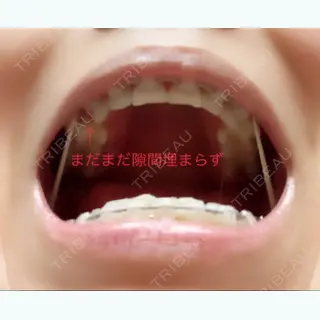 700日目の経過画像（3枚目）