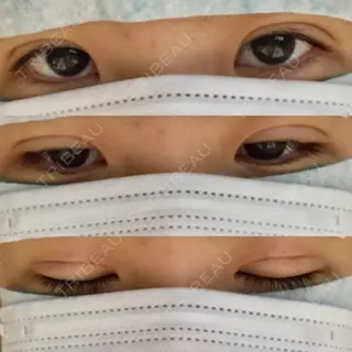 1日目の経過画像（1枚目）